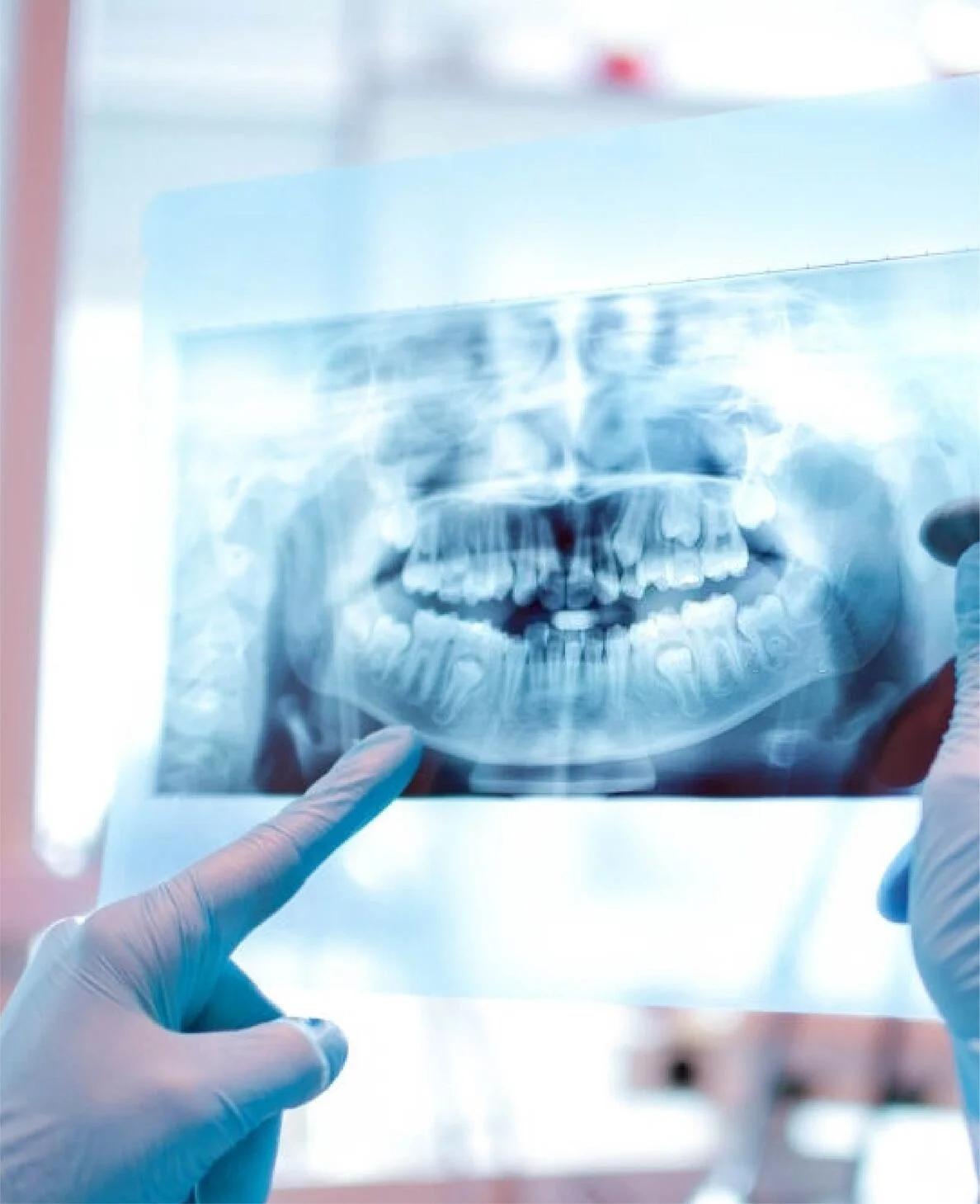 Clinician reviewing a dental X-ray